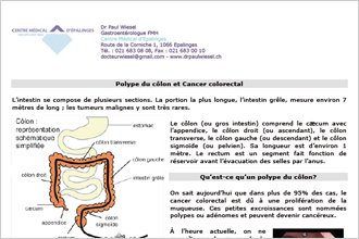 Polype du côlon et cancer colorectal